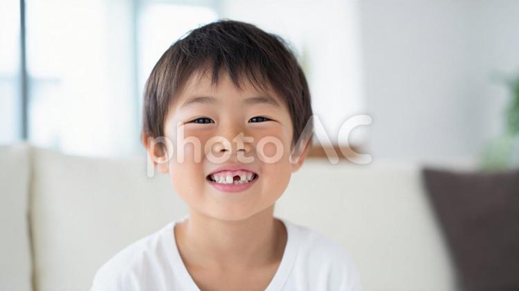 前歯が抜けた男の子 歯が抜けた,子ども,前歯の写真素材