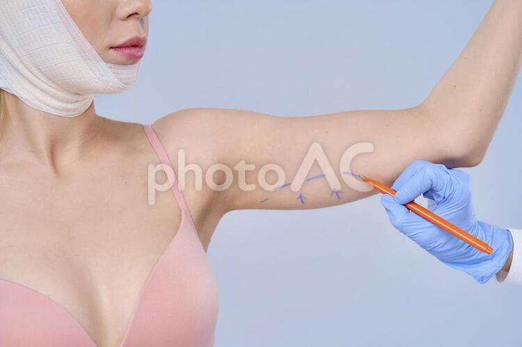 美容整形外科医に目印線を描かれている下着姿の女性 美容整形,女性,外国人の写真素材