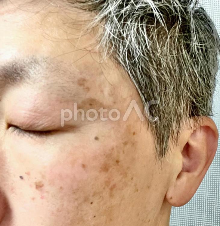 50代中年男性の顔のシミ 40代,50代,老化の写真素材