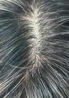 気になる分け目の広がり・シニアの悩み 頭頂部,髪,つむじの写真素材