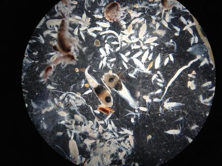 Plankton seen with a microscope Plankton seen with a microscope