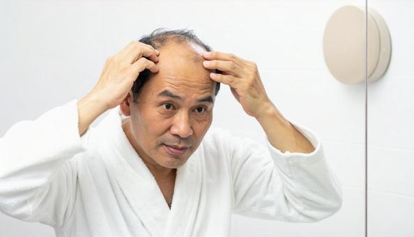 脱毛症 鏡を見て薄毛に悩む中年男性 脱毛症 鏡を見て薄毛に悩む中年男性の写真