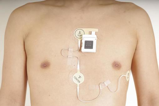 心電図ホルターを装着した中年男性の胸部 心電図,ホルター心電図,心拍数の写真素材