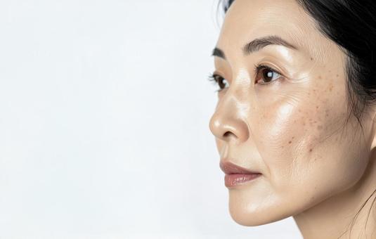 顔の色素沈着ケアの写真