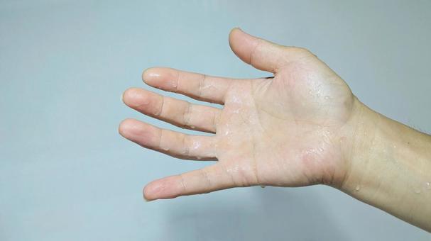 手掌多汗症で手汗が凄いことに 手掌多汗症で手汗が凄いことにの写真