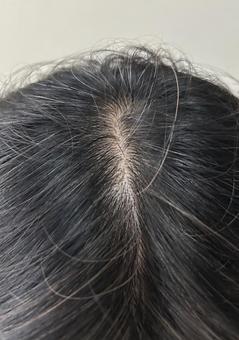 頭頂部の分け目の広がりが気になる 頭頂部,髪,つむじの写真素材