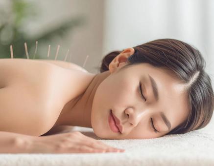 鍼治療をする女性 鍼治療をする女性の写真
