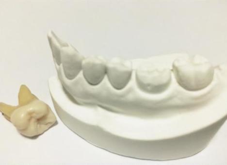 Dental health, JPG Dental health, JPG