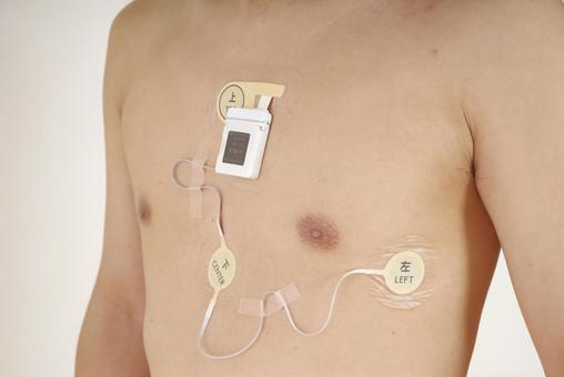 心電図ホルターを装着した中年男性の胸部 心電図,ホルター心電図,心拍数の写真素材