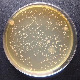 微生物 微生物 微生物,コロニー,細菌の写真素材