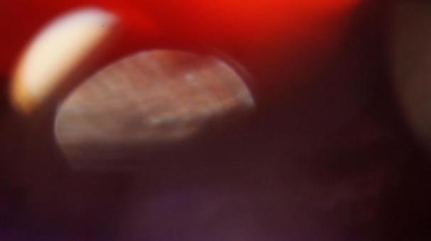光 光の写真