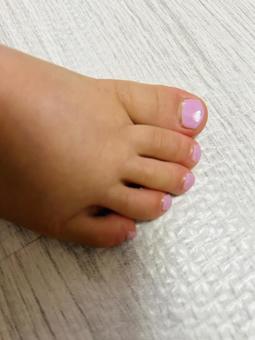 Photo, kids nail, foot, leg, 