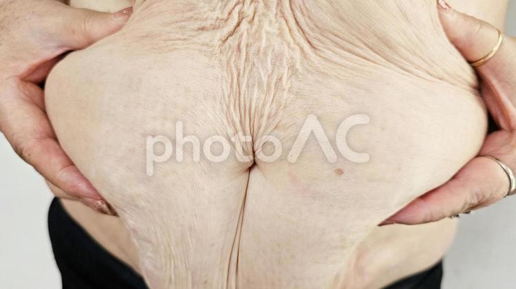 お腹の脂肪　７０代女性3 お腹の脂肪,70代女性,皮下脂肪の写真素材