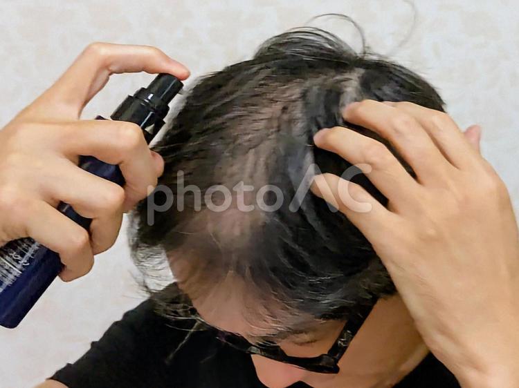 地肌の部分に育毛剤をスプレーする男性 薄毛,地肌,細毛の写真素材