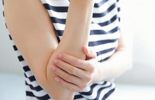 女性の腕　整形外科 女性,腕,上腕の写真素材