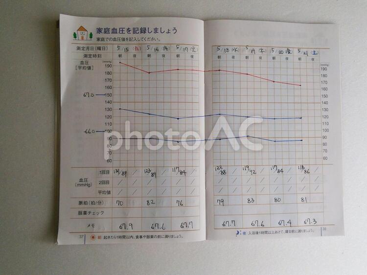 50代の男性の血圧の グラフ 高血圧,成人病,50代の写真素材