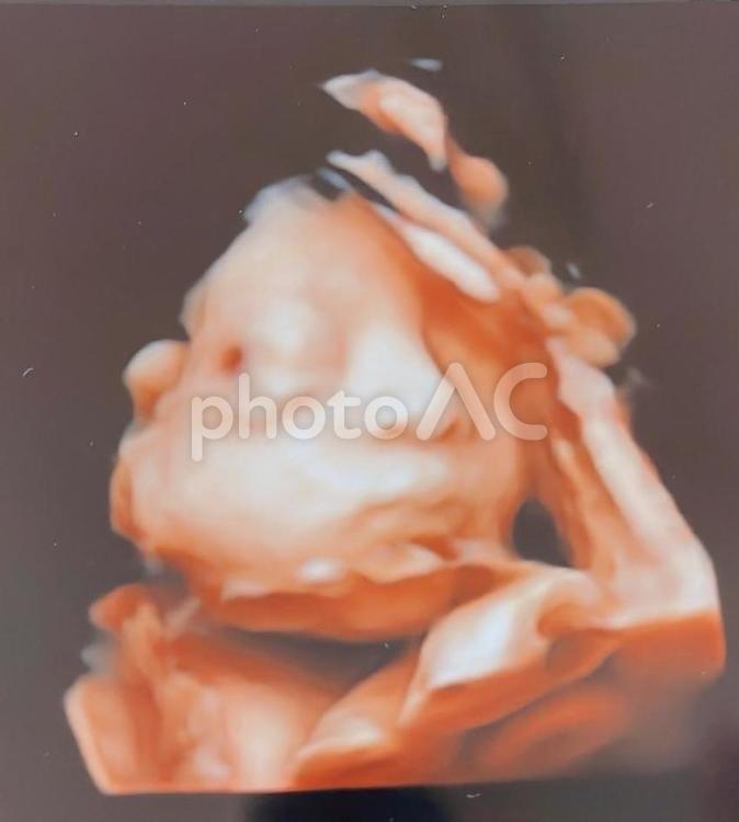 赤ちゃんのエコー写真（約8か月） 赤ちゃん,妊娠,妊婦の写真素材