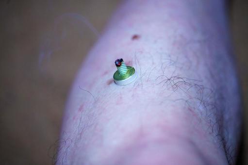 ツボへのお灸で体調を整える ツボへのお灸で体調を整えるの写真