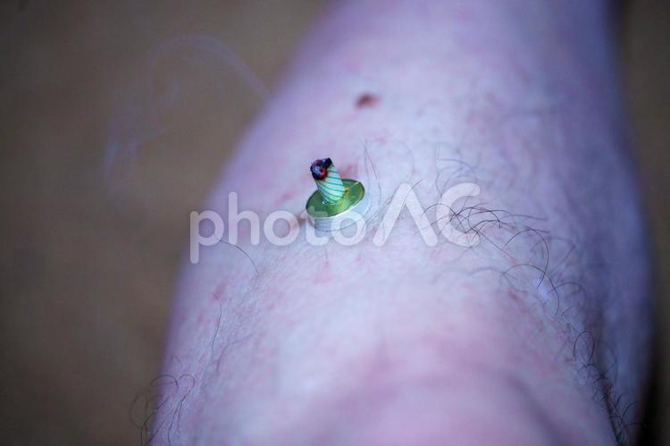 ツボへのお灸で体調を整える 東洋,ツボ,治療の写真素材