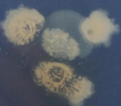 微生物 微生物 微生物,コロニー,実験の写真素材
