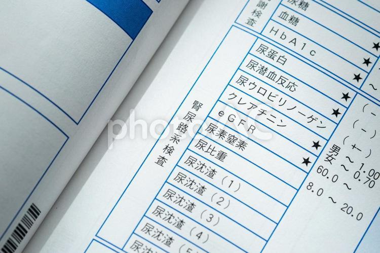 健康診断（腎尿路系検査） 健康診断,腎尿路系検査,尿検査の写真素材