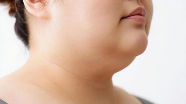 二重あごの写真