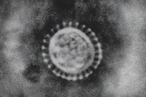 Image of a virus seen under a microscope, virus, microscope, image, JPG