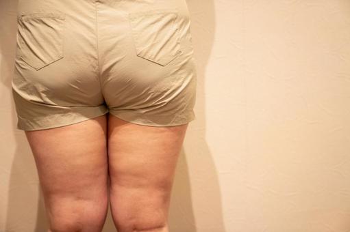排出されない太もものセルライト ダイエット,セルライト,脂肪燃焼の写真素材