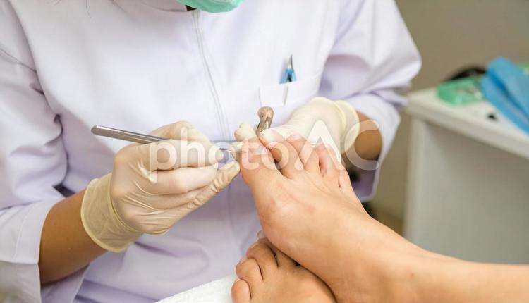 巻き爪の客の治療をする白衣の女性 指,女性,アジア人の写真素材