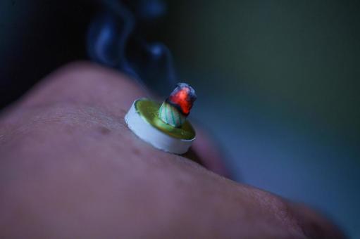 ツボへのお灸で体調を整える ツボへのお灸で体調を整える 東洋,ツボ,治療の写真素材