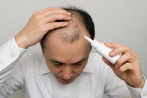 AGA治療を行う男性の手元 AGA治療を行う男性の手元の写真
