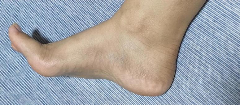 足 足,裸足,素足の写真素材