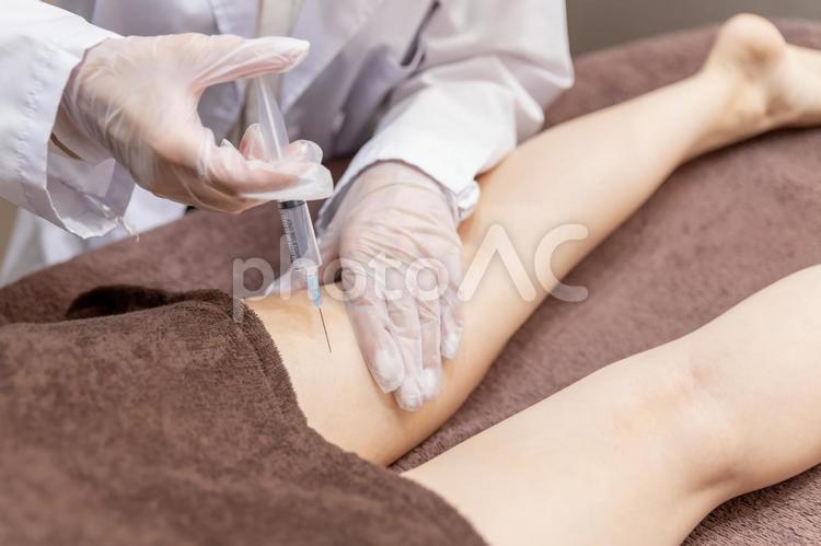 美容外科で施術を受ける女性（注射・太もも） 脂肪溶解注射,メソセラピー,ボトックス注射の写真素材