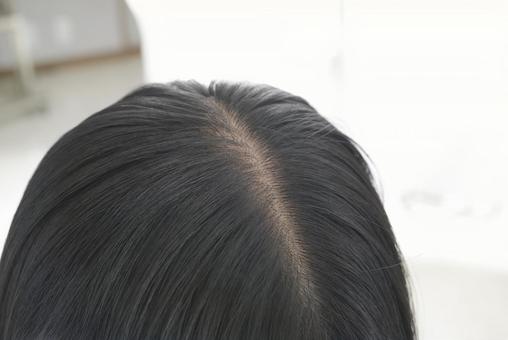 女性の髪の毛の分け目 女性の髪の毛の分け目 分け目,地肌,薄毛の写真素材