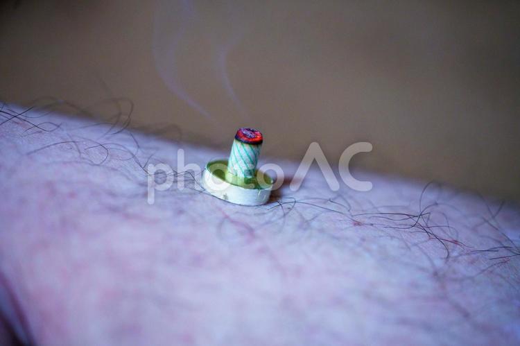 ツボへのお灸で体調を整える 東洋,ツボ,治療の写真素材
