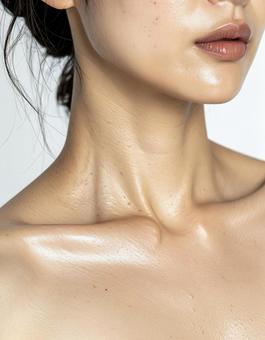 デコルテの色素沈着の写真