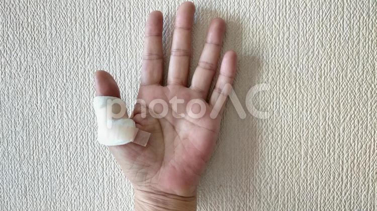 バネ指の手術-抜糸後のガーゼ バネ指,バネ指の手術,手の手術の写真素材