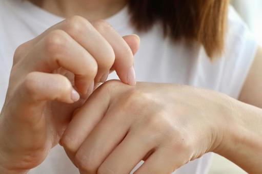 Photo, to scratch, itch, hand, 