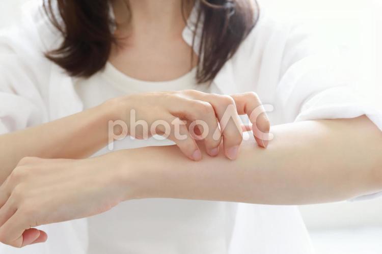 腕のかゆみ　皮膚科 腕,かゆみ,アトピーの写真素材