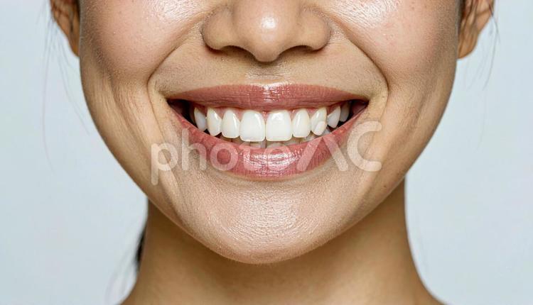 口を大きく開けて笑う女性。歯科の素材用 白い歯,女性,笑顔の写真素材