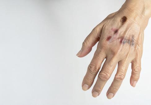 加齢によるシミ対策 加齢によるシミ対策の写真