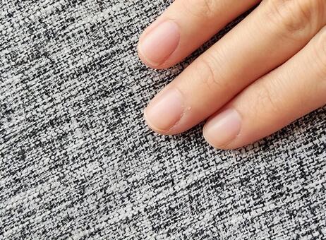 ささくれ ささくれ,さかむけ,手荒れの写真素材