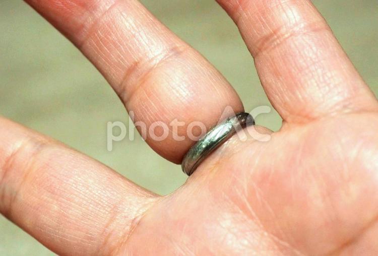 指輪　抜けない指輪 外れない指輪　指輪が食い込んだ指 指輪,抜けない指輪,食い込みの写真素材