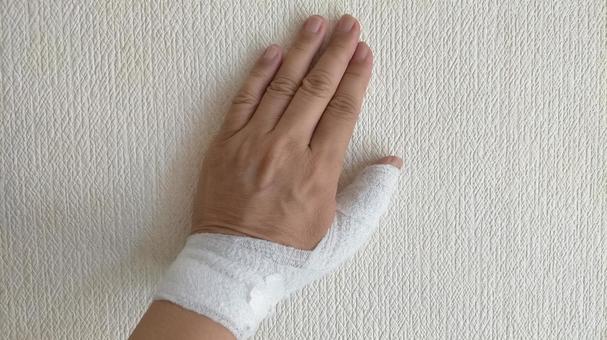 バネ指,手術当日 バネ指,手術当日 バネ指,バネ指の手術,手の手術の写真素材