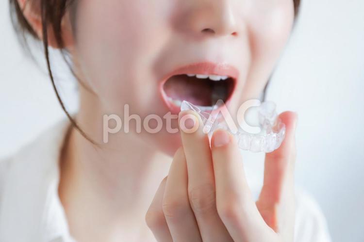 マウスピースを装着する女性　矯正治療 マウスピース,審美歯科,歯科矯正の写真素材
