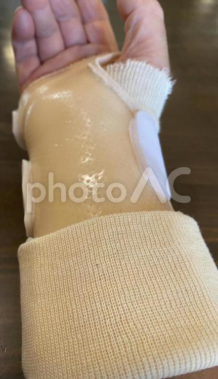 ギプスをした手 手,怪我,骨折の写真素材
