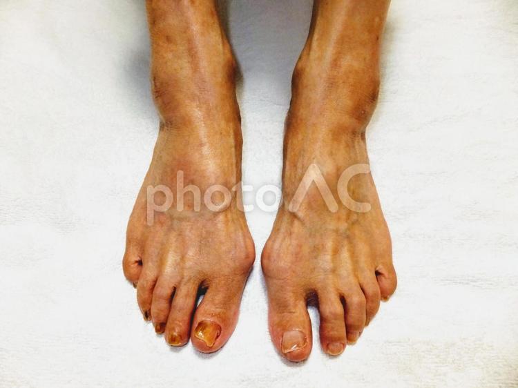 足湯とフットケアをした直後の高齢女性(88才)の足 足湯,フットケア,老人の写真素材