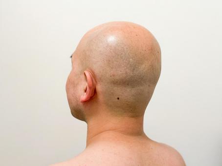 スキンヘッドの男性 薄毛,男性,髪の毛の写真素材