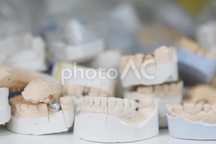 歯の石膏模型 歯医者,歯,模型の写真素材