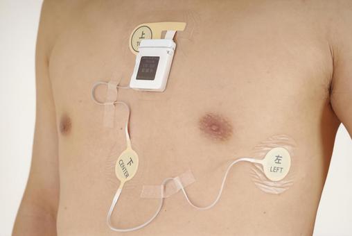 心電図ホルターを装着した中年男性の胸部 心電図,ホルター心電図,心拍数の写真素材